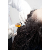 clinica especializada em tratamento de cabelo telefone Vila Cristelo