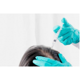 clínica que faz plasma para queda de cabelo Vila Arbame