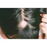 clínica que faz tratamento para queda e crescimento de cabelo Mogilar