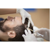 consulta de dermatologista especialista em cabelo Vila Barra Funda
