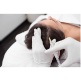 dermatologista especialista em queda de cabelo marcar Biritiba