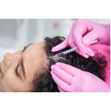 mesoterapia para crescer cabelo agendar Vila Varela