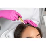 Tratamento para Queda de Cabelo e Crescimento Mogi das Cruzes