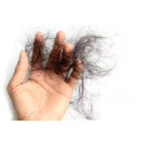 tratamento capilar para queda de cabelo Vila Amélia