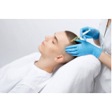 tratamento de plasma para queda de cabelo Vila Áurea