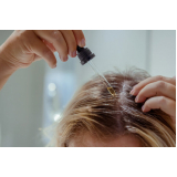 tratamento para crescer cabelo Vila Ruth