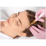 tratamento para queda de cabelo feminino Vila Arquimedes